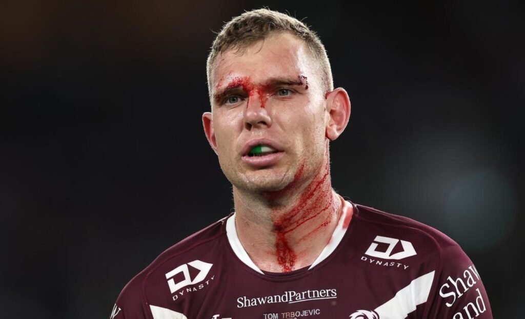 tom trbojevic manly sea eagles shoulder injury nrl finals