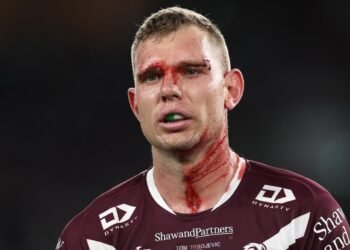 tom trbojevic manly sea eagles shoulder injury nrl finals