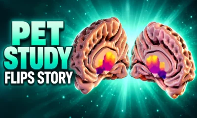 Danish PET study extra D2 binding autism thalamus